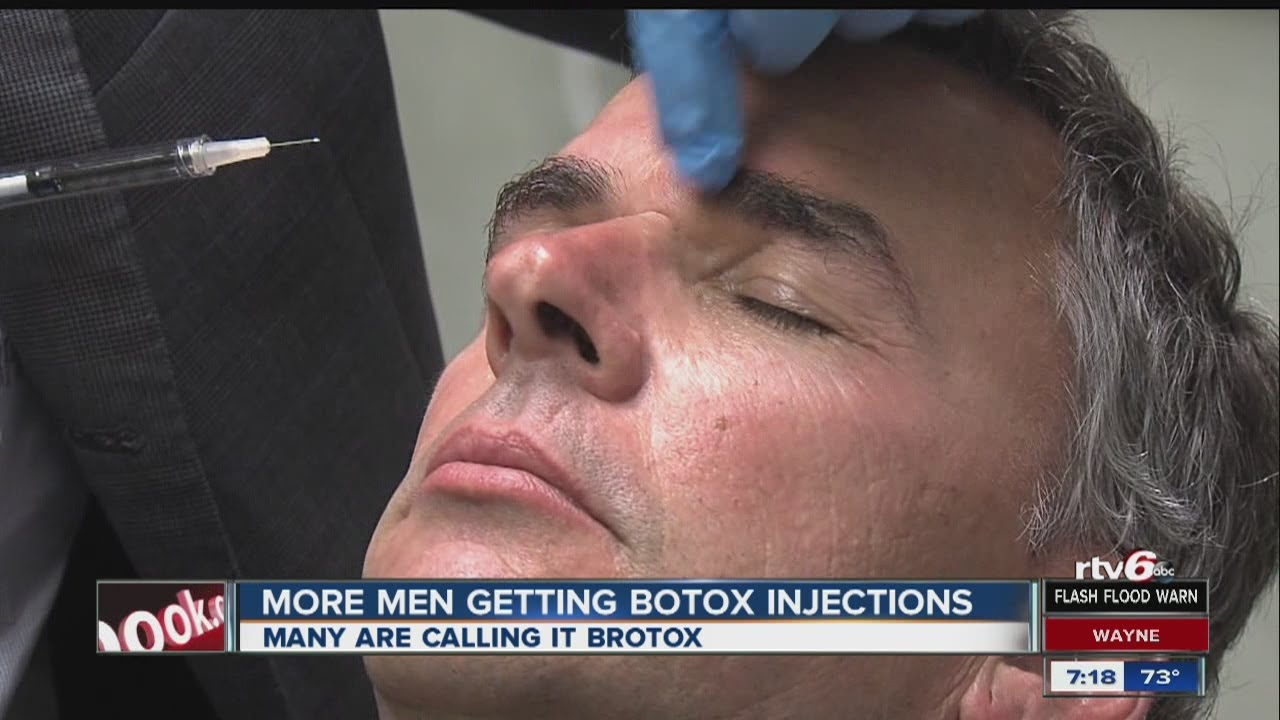 More men getting Botox injections, doctors say