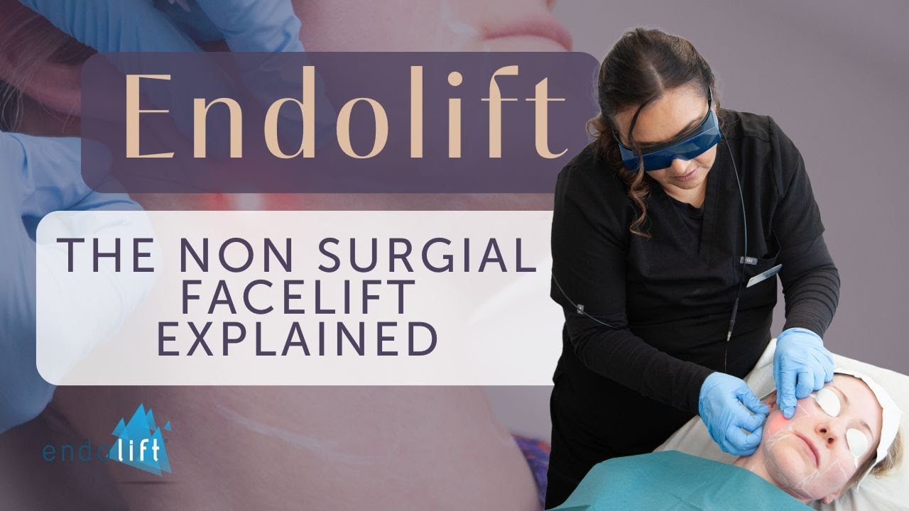 Endolift Non Surgical Facelift Explained