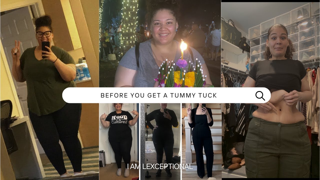 Before You Get a Tummy Tuck: Why I’m Seeing Doctors In-Person (Not Just Online)
