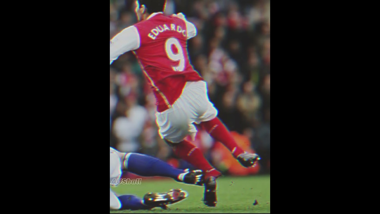 It's just a tackle... #football #soccer #injury #eduardo #tackle