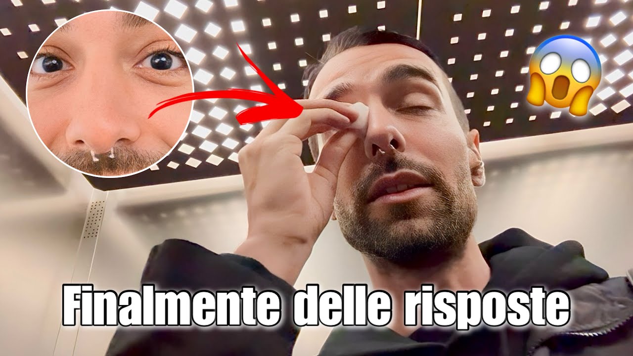 COSA È SUCCESSO AI MIEI OCCHI? | Vlog 19/ottobre/2023