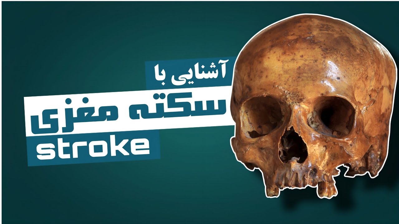 اگر این نشانه‌ها رو دیدی، فوراً با اورژانس تماس بگیر! [آشنایی با سکته مغزی]