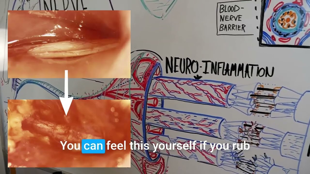 How do nerves get injured -- and how can they heal?
