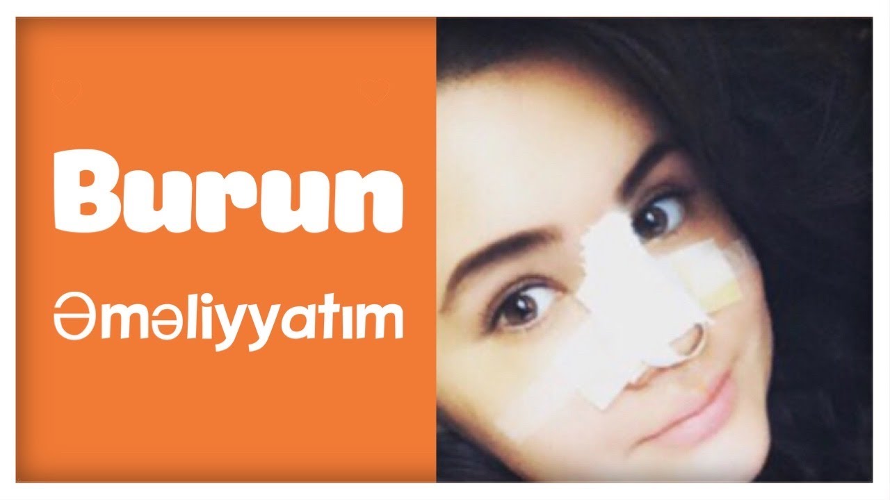 Burun əməliyyatım/Şikayətlərim👎🏻