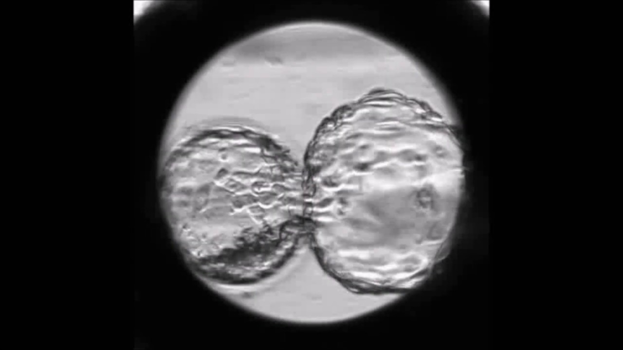 Human frozen-thawed blastocyst morphokinetics observed using time-lapse cinematography reflects