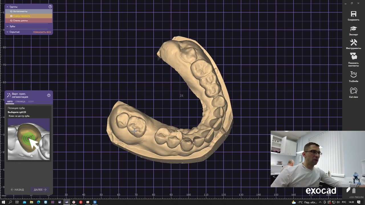 2 часть: CAD\CAM. 3D cканирование в Medit,  Exocad модельер и печать временных конструкций.