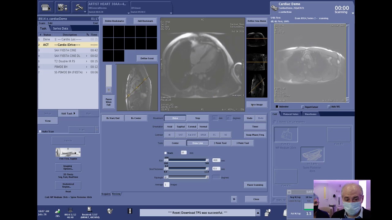 Cardiac Imaging SIGNA™Works AIR™ IQ Edition
