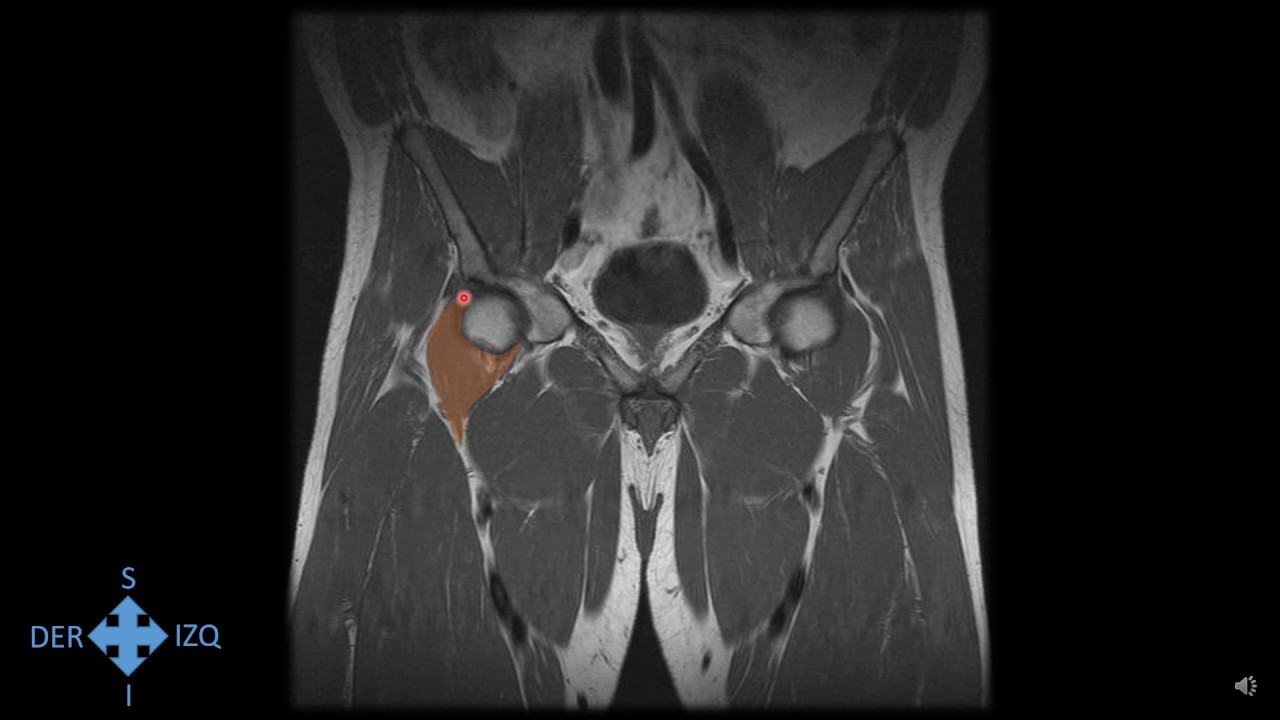 L3.2 | Pelvis, región glútea y muslo | Anatomía 2 | FMed UBA