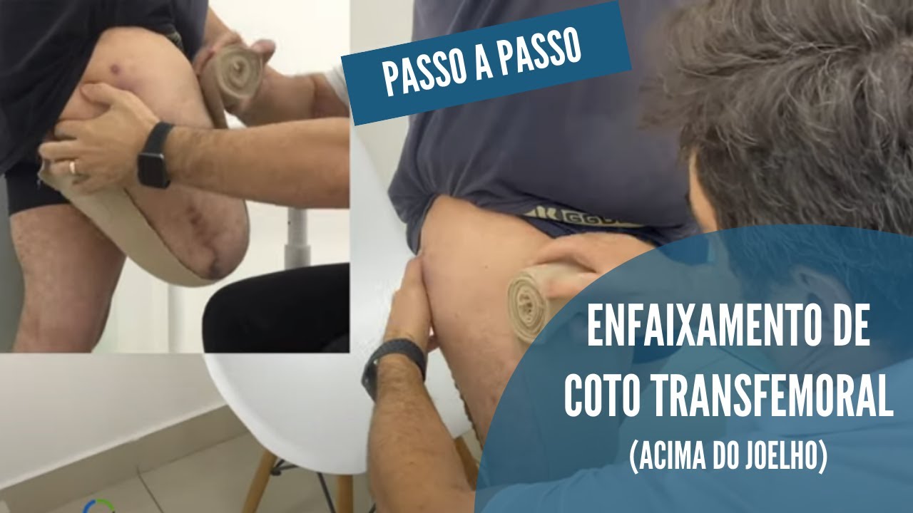 Enfaixamento do Coto -  Compressivo em 