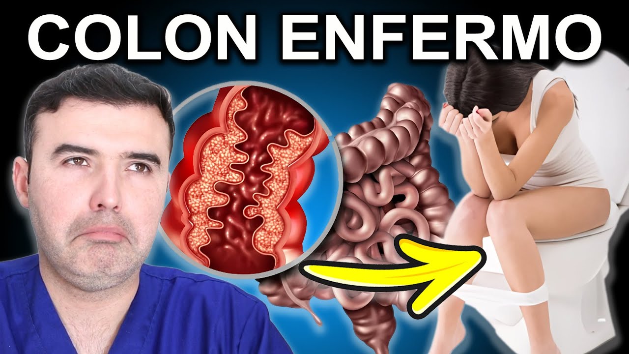 DIETA y ALIMENTOS para un CÁNCER de COLON e HÍGADO (Y otras enfermedades) | Dr. Landívar