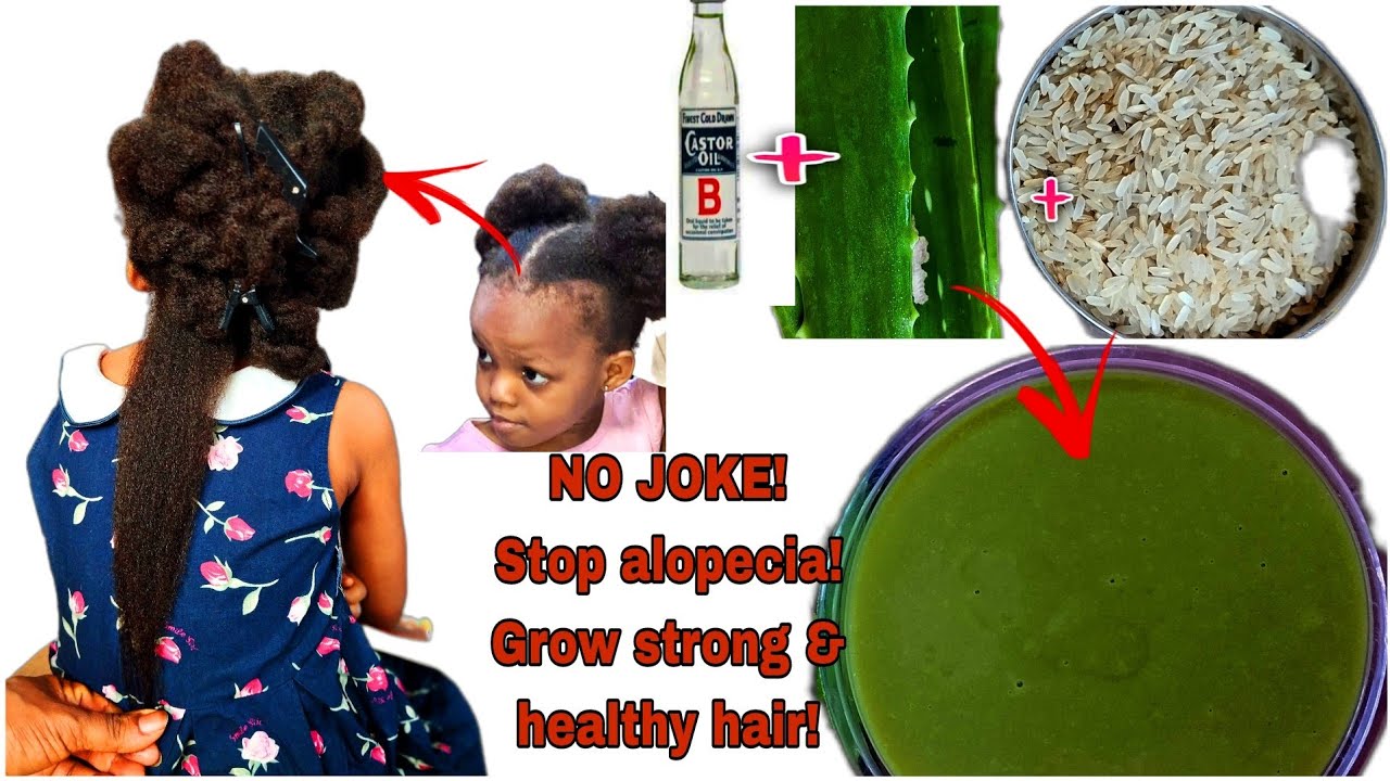 NO JOKE! ONLY 3 POWERFUL INGREDIENTS| HER NATURAL HAIR GREW FAST