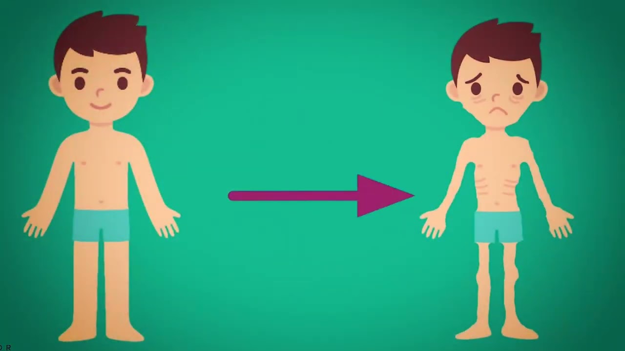 عدم تشخیص و درمان به موقع دیابت در کودکان موجب کاهش هوشیاری آنها شود