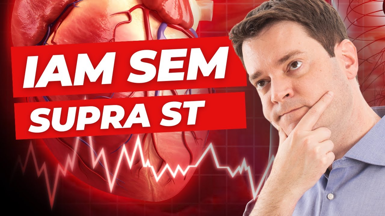 IAM sem supra de ST: a conduta que não pode faltar neste atendimento