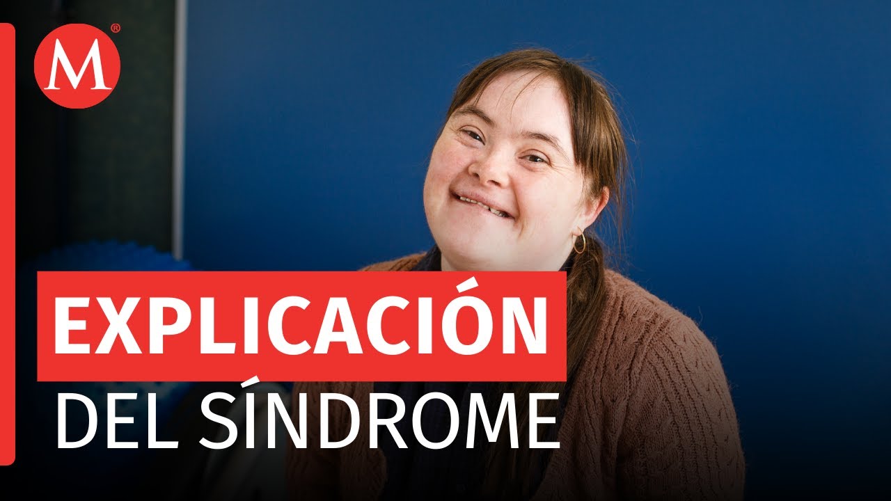 Doctor explica todo sobre el S&iacute;ndrome de Down