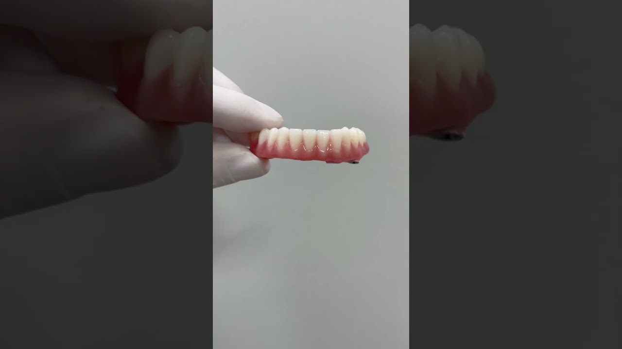 Protocolo sobre implantes