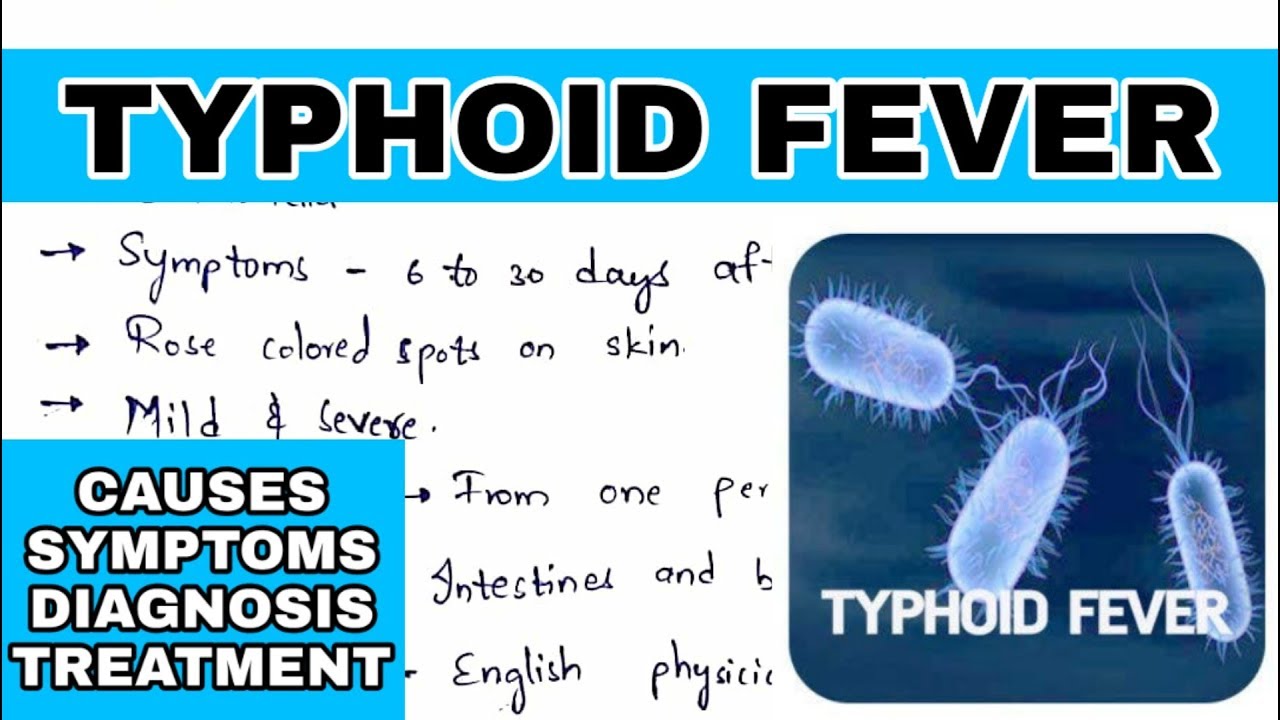 Typhoid fever | Salmonella typhi | Causes, symptoms, diagnosis, treatment | Bio science