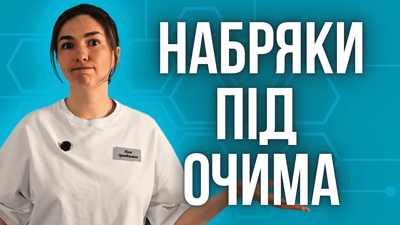 Як позбутися набряків і мішків під очима - ефективні способи про які ви точно не чули!