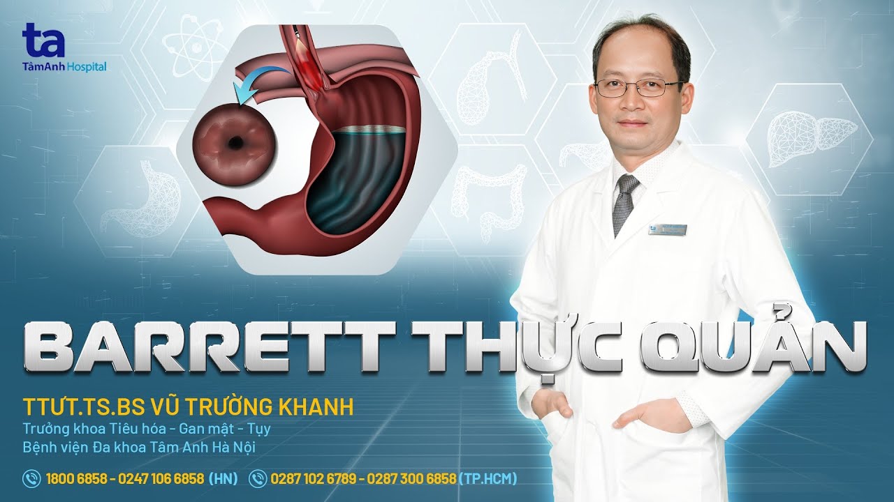 Barrett thực quản: Nguyên nhân, triệu chứng | TTƯT.TS.BS Vũ Trường Khanh | THTA