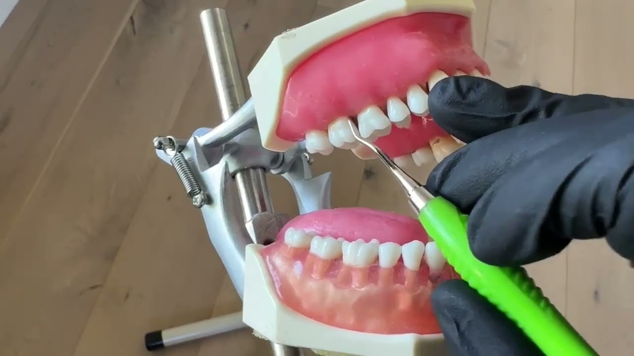 The Difference Between Adaption and Angulation with Dental Hygiene Instruments