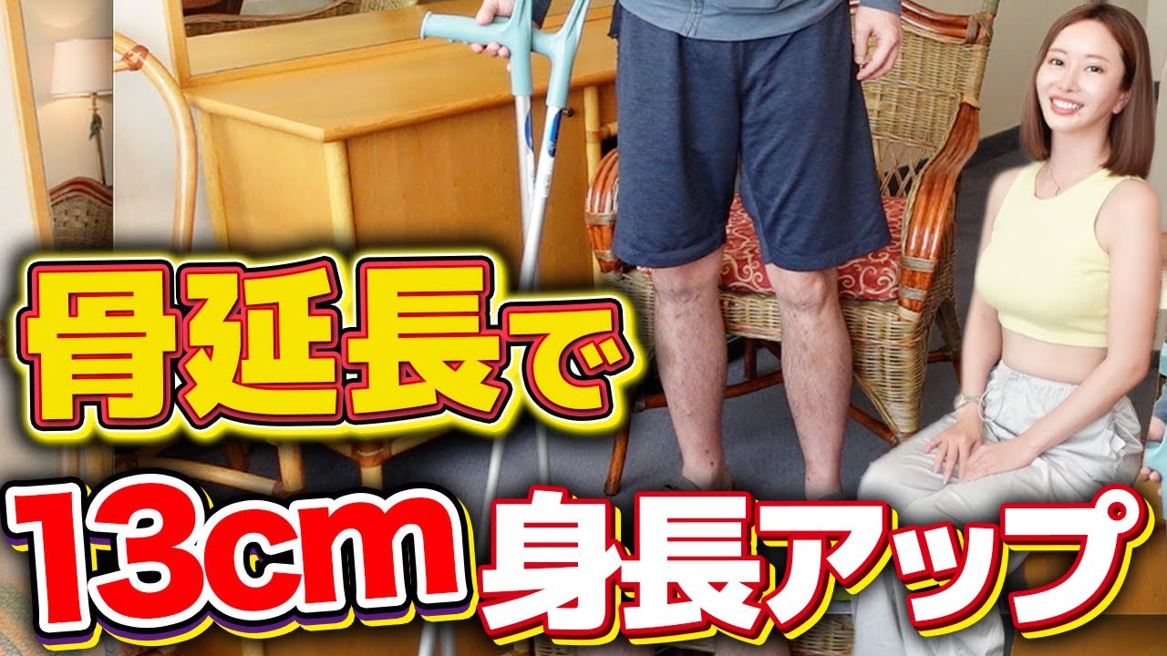 骨延長で13cm足を伸ばして低身長コンプレックス解消しました。