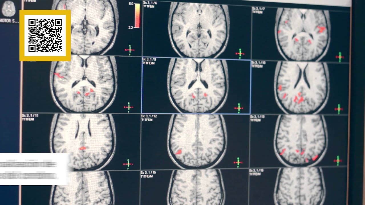 El Mapa Digital - Resonancia y Tractograf&iacute;a