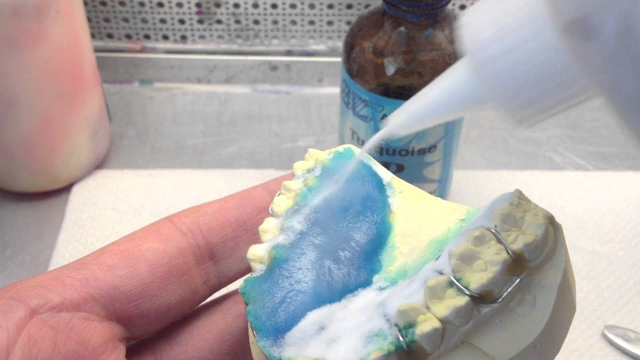 Acrylic Application on a Retainer- Salt and Pepper Method
