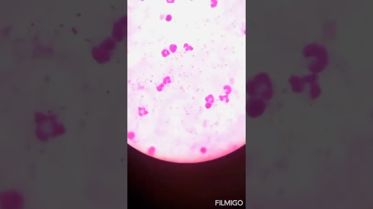 how to count #malaria trophozoites. #amazing #youtube