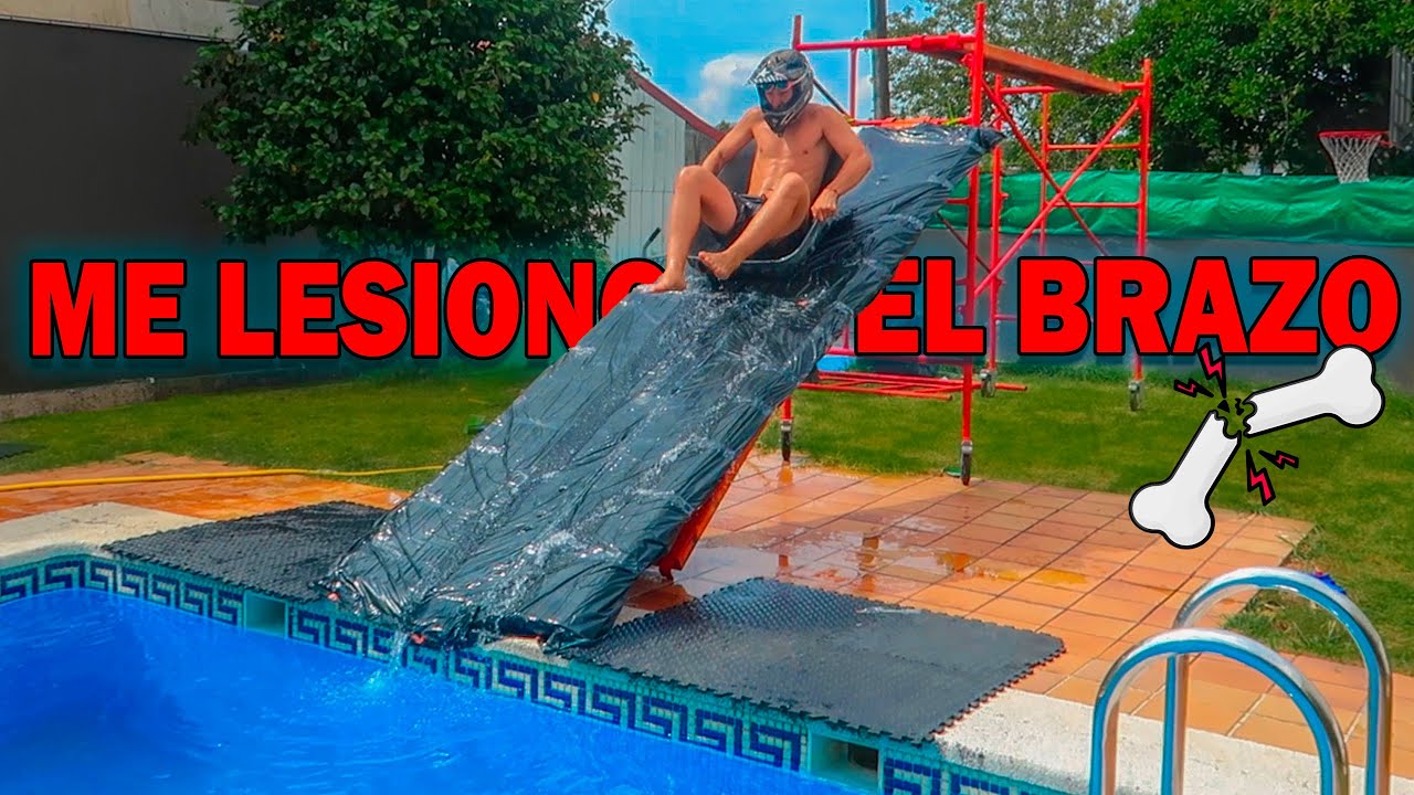 ¡EL NUEVO TOBOGÁN ME ROMPIÓ EL BRAZO! No volveré a probarlo... 