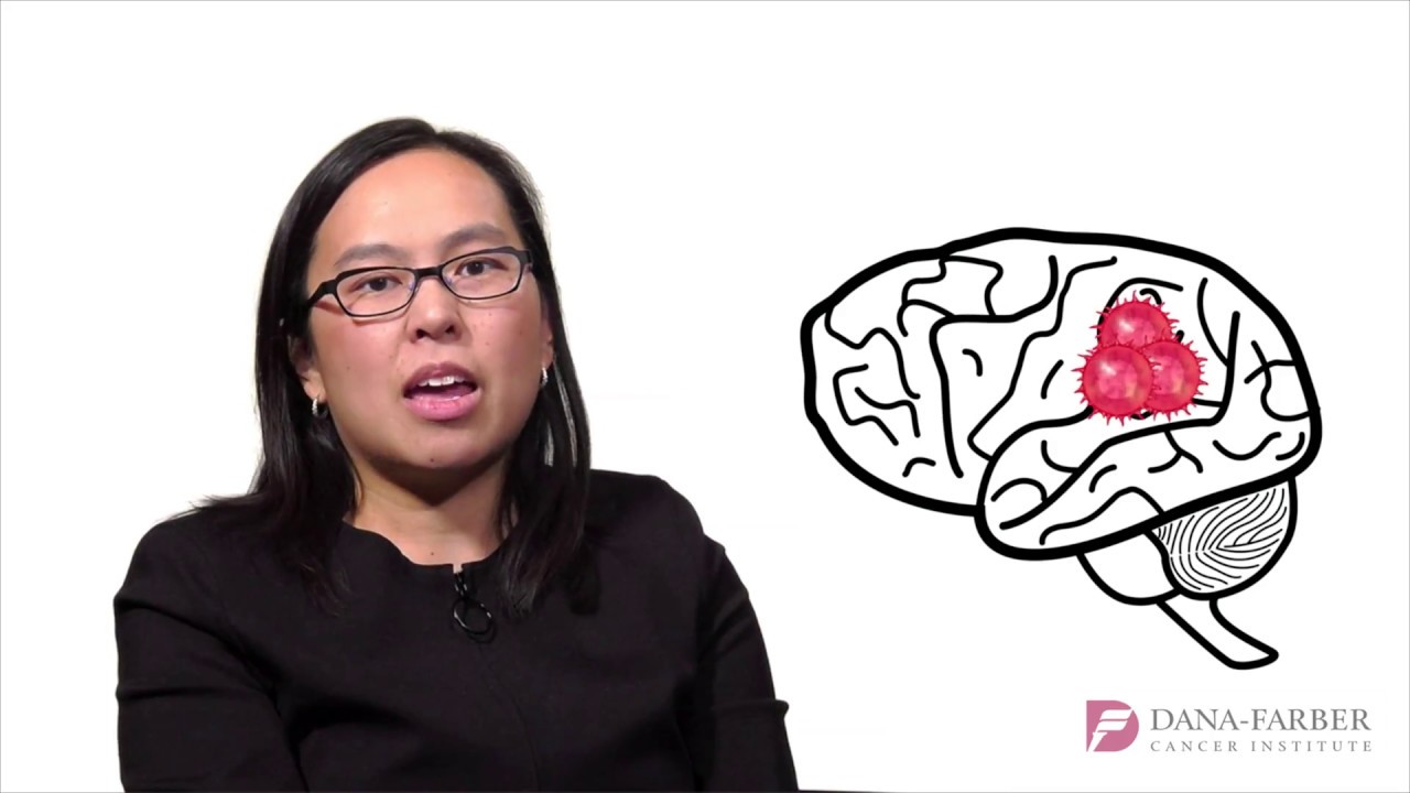 Signs and Symptoms of a Brain Tumor | Dana-Farber Cancer Institute