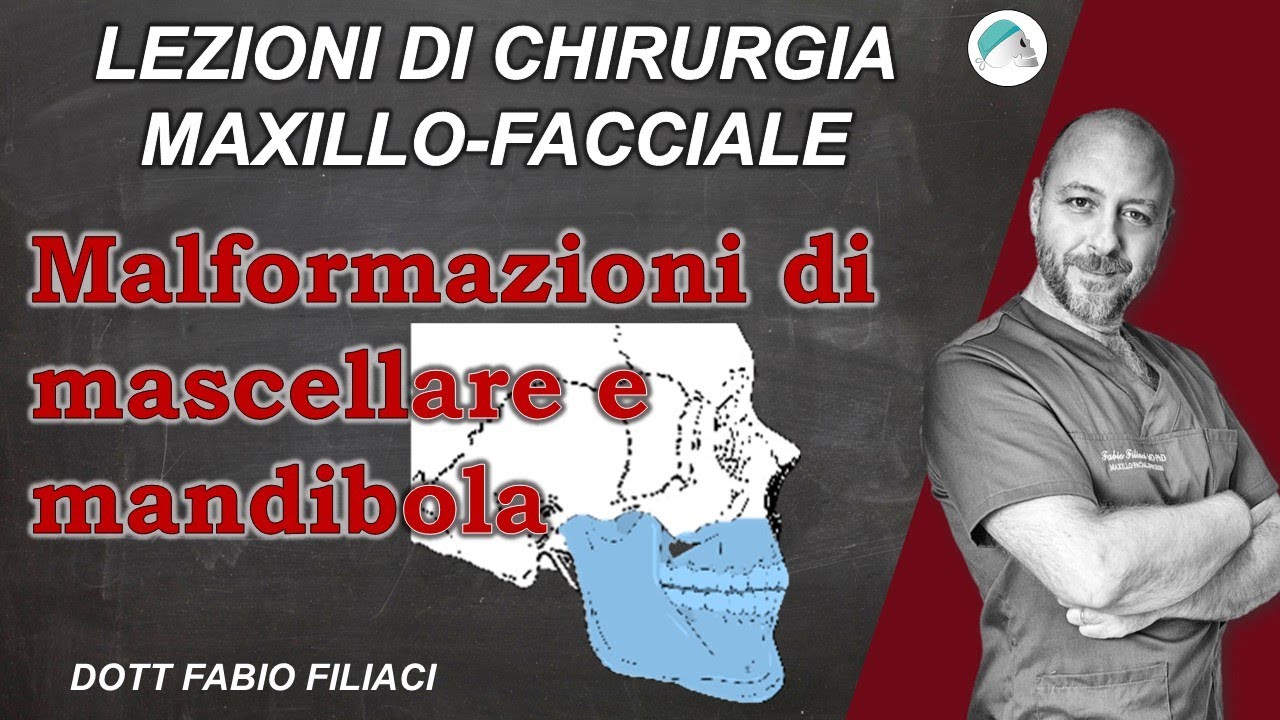 Lezioni di chirurgia maxillo facciale: Le malformazioni del mascellare e della mandibola