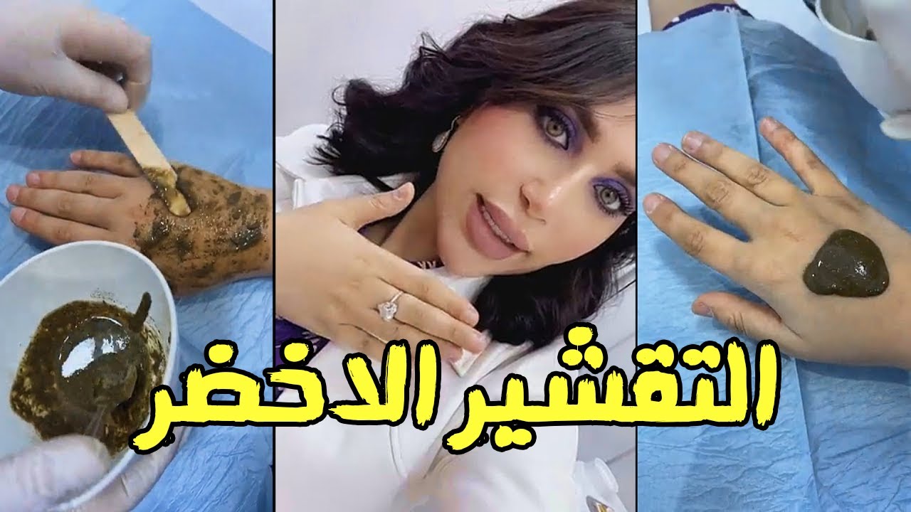 دكتوره خلود تسوي التقشير الأخضر الطبيعي ليدها في عيادتها🔥
