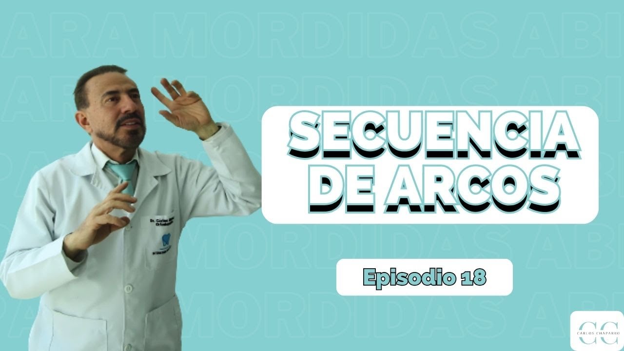 ✅ Secuencia de arcos - Episodio 18