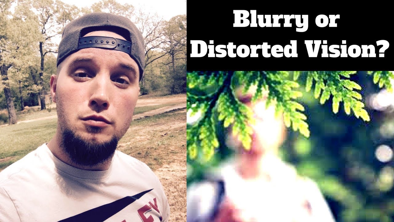 Anxiety and Distorted or Blurry Vision