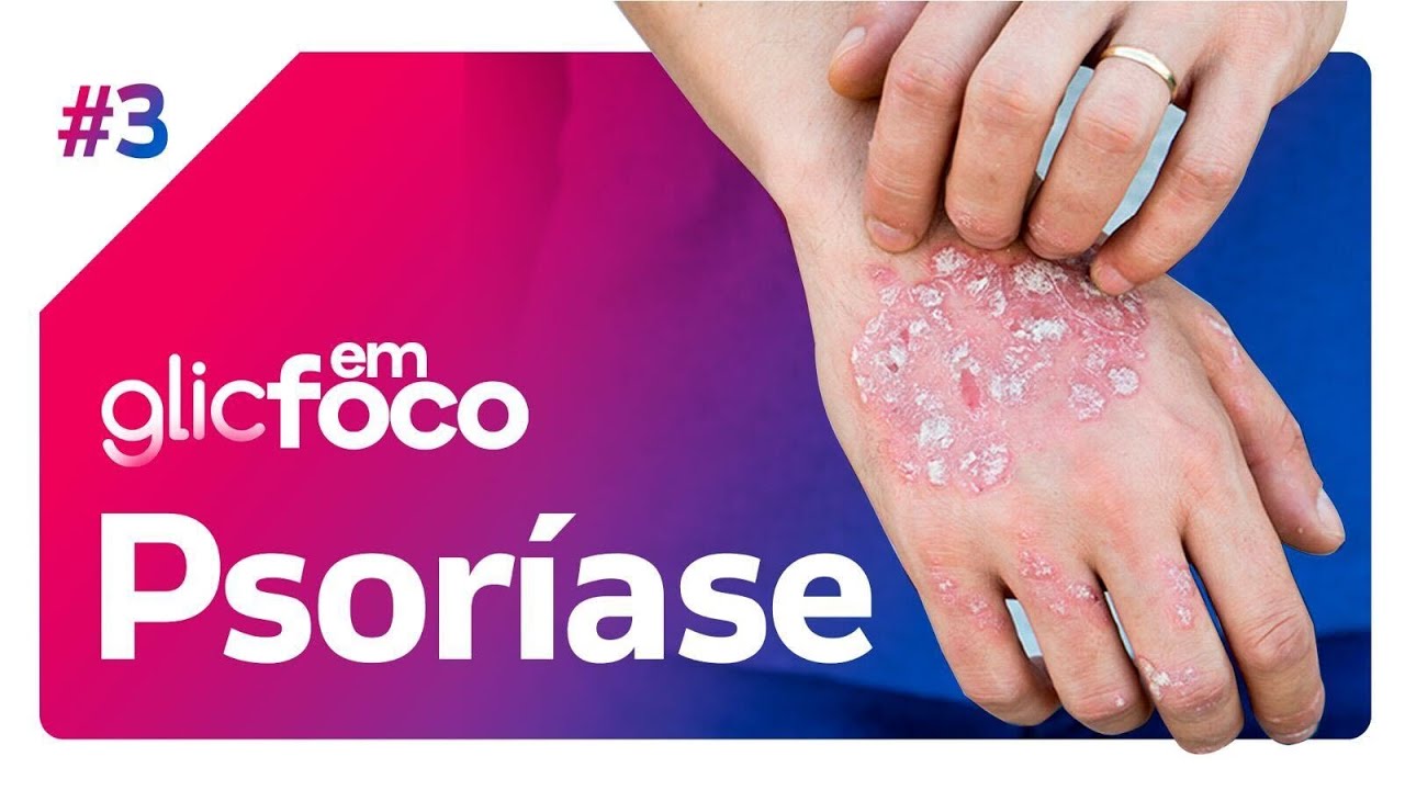 Psoríase | Glic em Foco #3