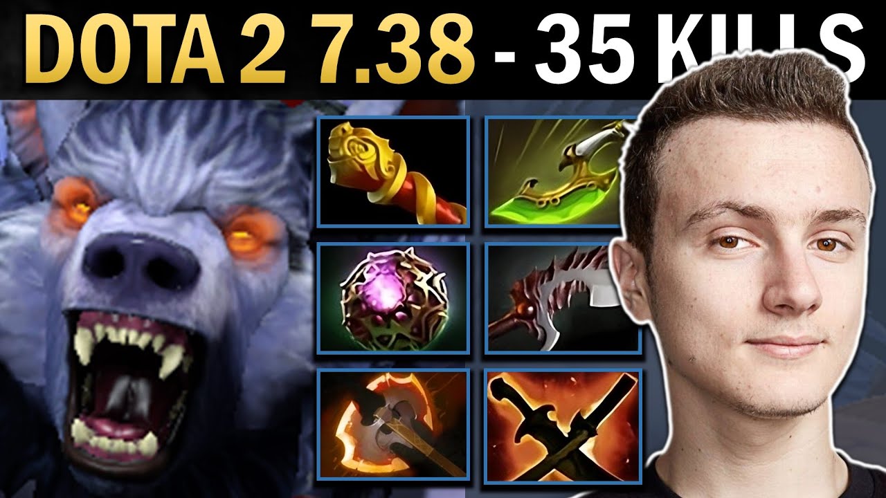 Ursa Gameplay Miracle with 35 Kills and Abyssal - Dota 2 7.38