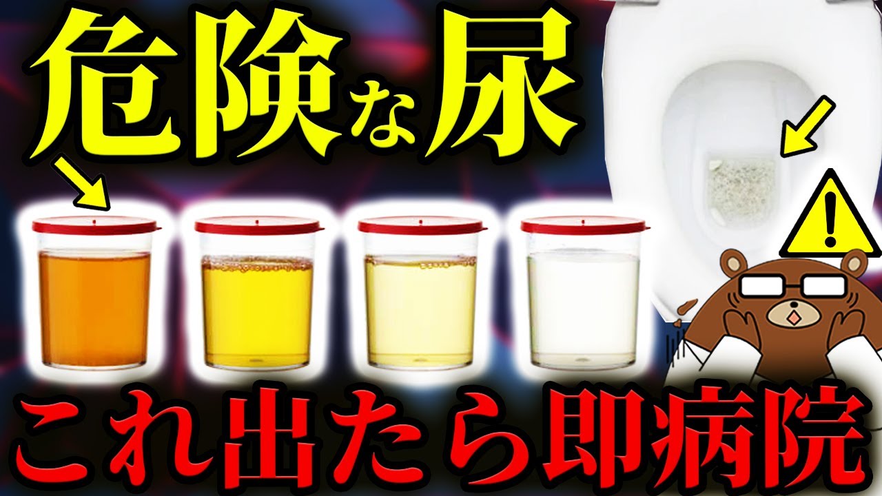 泡立ち.色.臭い..放置厳禁！絶対に知らないと後悔する「尿でわかる病気のサイン」の見分け方。「痛くないおしっこ」が逆に危険？「消えない泡」の正体とは。頻尿は何回から要注意？医師が完全解説！