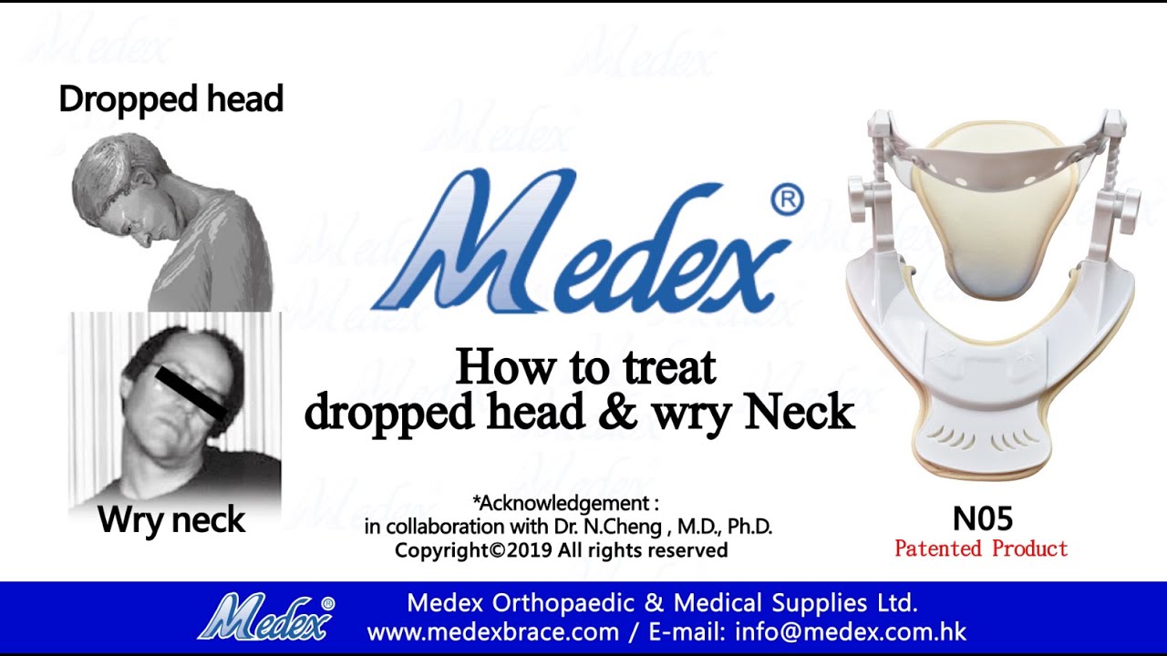 N05 - How to treat dropped head & wry neck  (3D Animation)