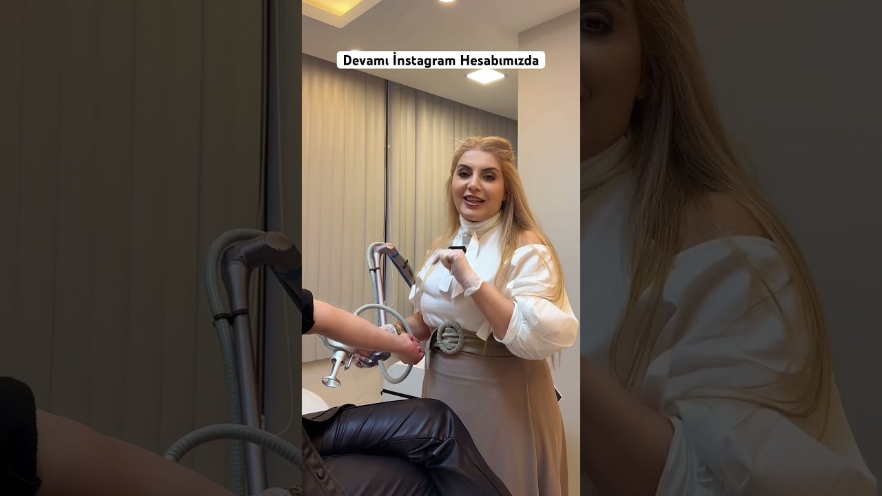 CO2 Fraksiyonel Lazer İle Jilet İzi Tedavisi. Devamı #meryestetik İnstagram hesabında