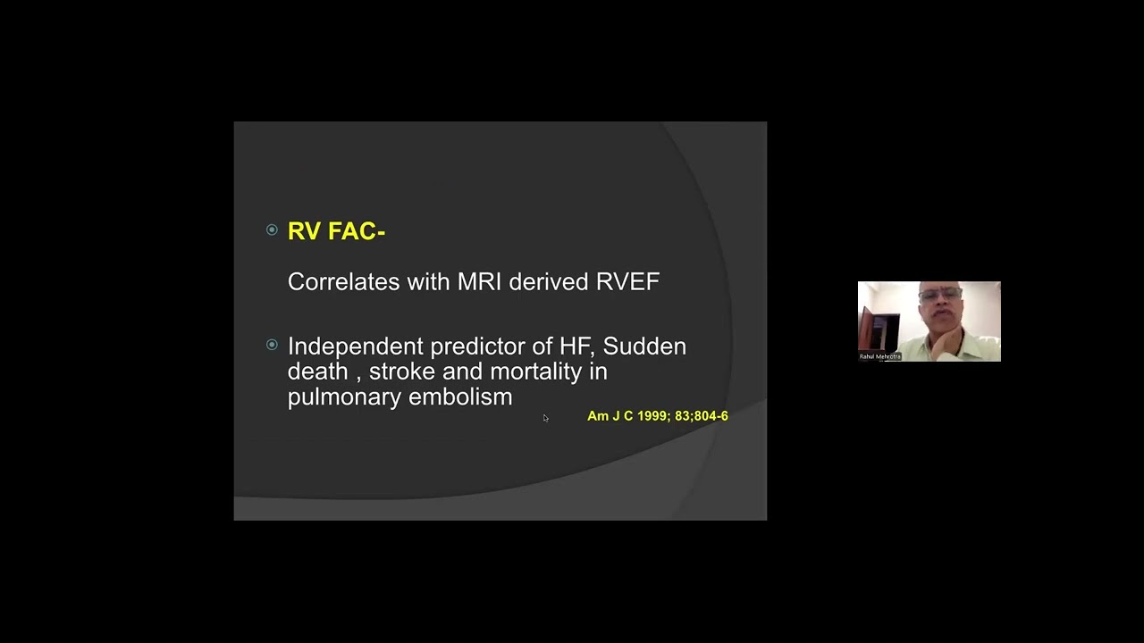 52nd 17 Session - Right heart hemodynamics by Dr Rahul Mehrotra