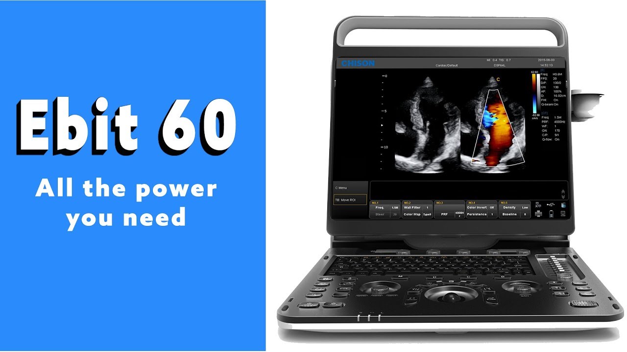 EBit 60 Portable Ultrasound