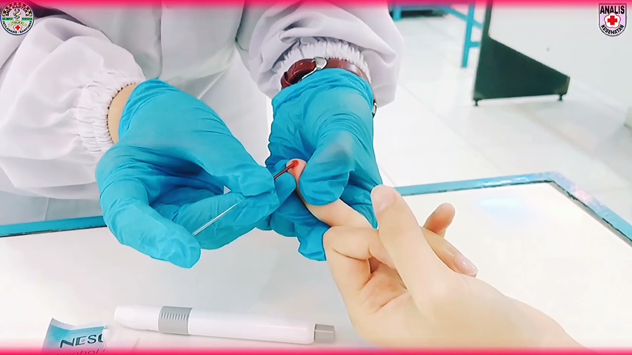Pemeriksaan Hematokrit Metode Mikro, Dengan Darah Kapiler