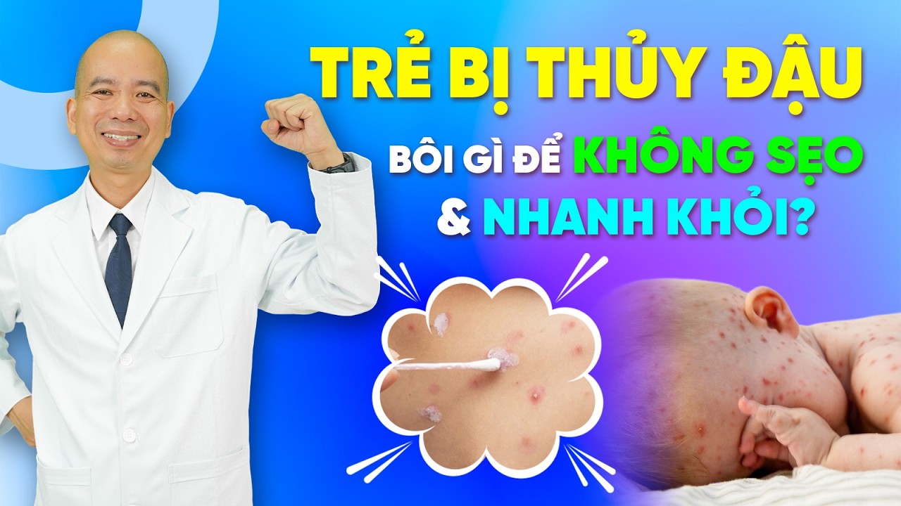Trẻ bị THỦY ĐẬU nên BÔI GÌ để NHANH KHỎI và KHÔNG ĐỂ LẠI SẸO | Bác sĩ Lê Xuân Dương