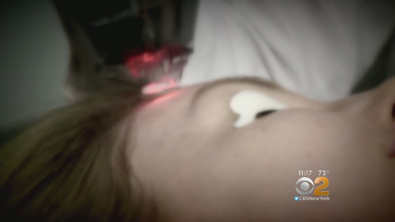 Skin Scare: Laser Treatments Could Increase Risk Of Cancer