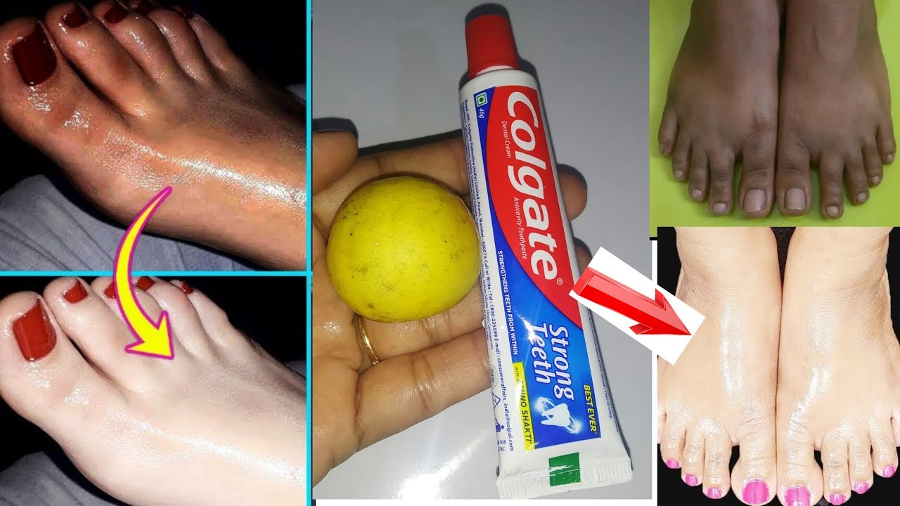 Foot Whitening Colgate Toothpaste At Home Remedies | Feet Whitening Pedicure At Home