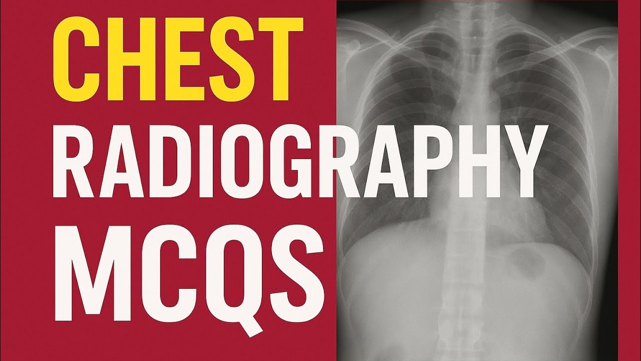 CHEST RADIOGRAPHY IMPORTANT MCQS FOR RADIOGRAPHER / X RAY TECHNICIAN EXAMS 🎯🎯🎯📌📌