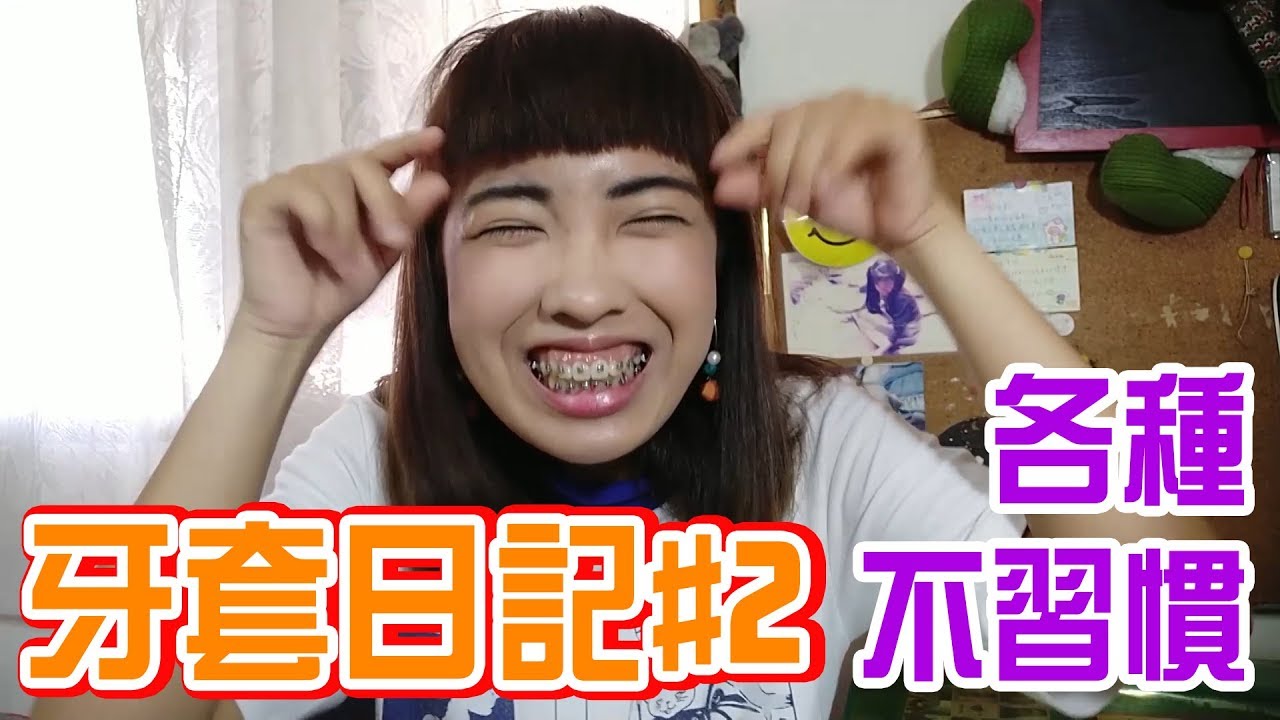 牙套日記#2 戴牙套後的各種不習慣｜移動岑寶