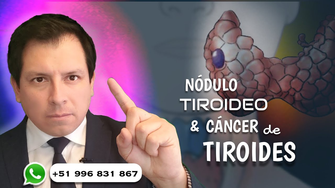 NÓDULO TIROIDEO Y CANCER DE TIRODIES