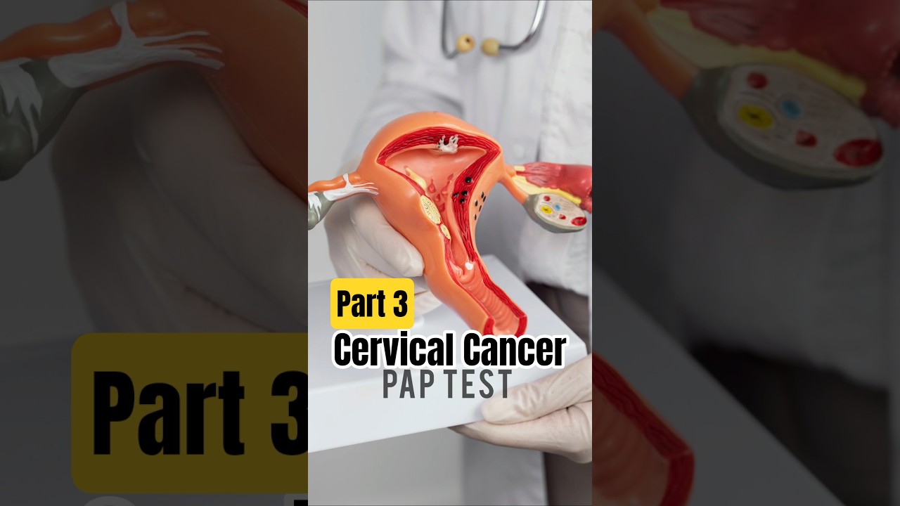 Cervical Cancer 