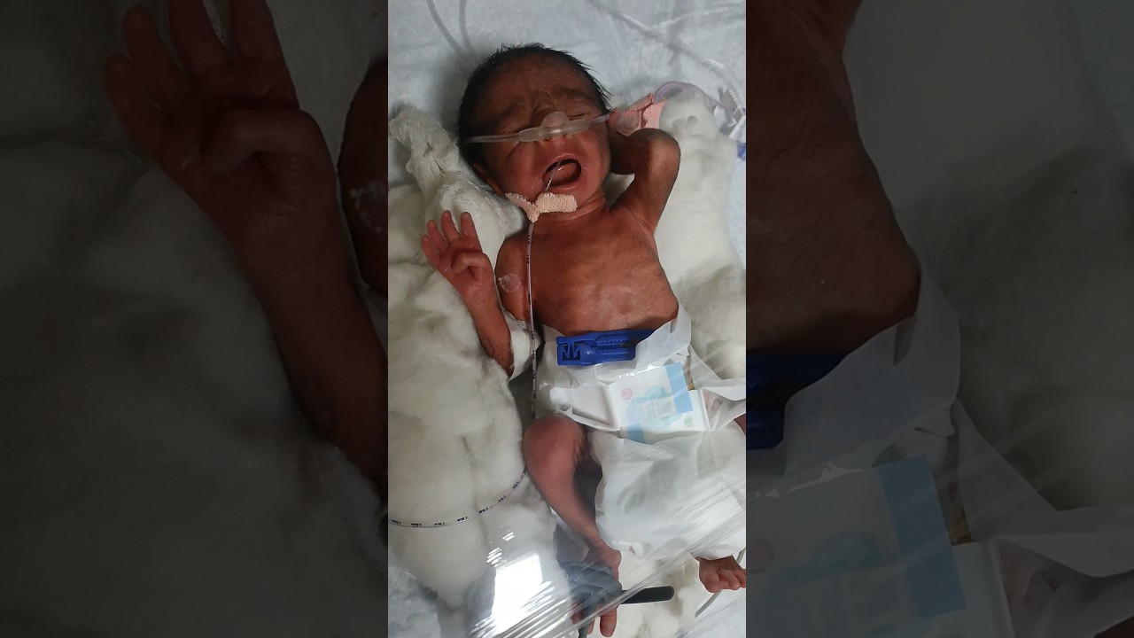very preterm baby 6 month weight 900 gram cry 🥵