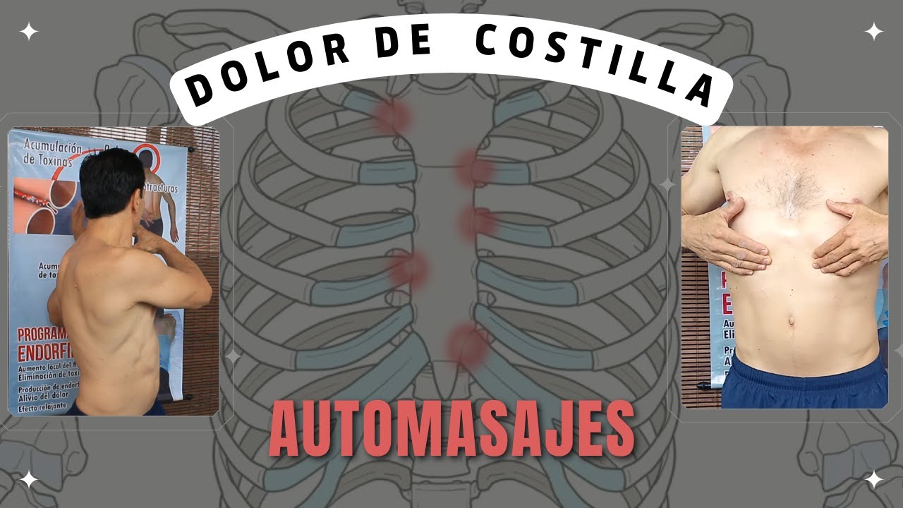 Costocondritis / Dolor de Costilla